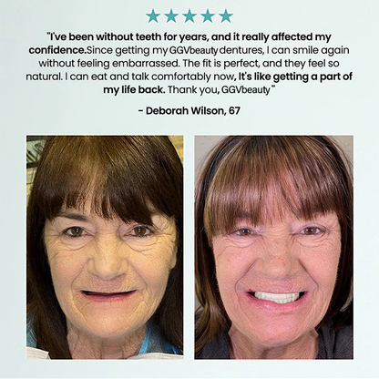 Fit Full Functional Dentures Make you more confident