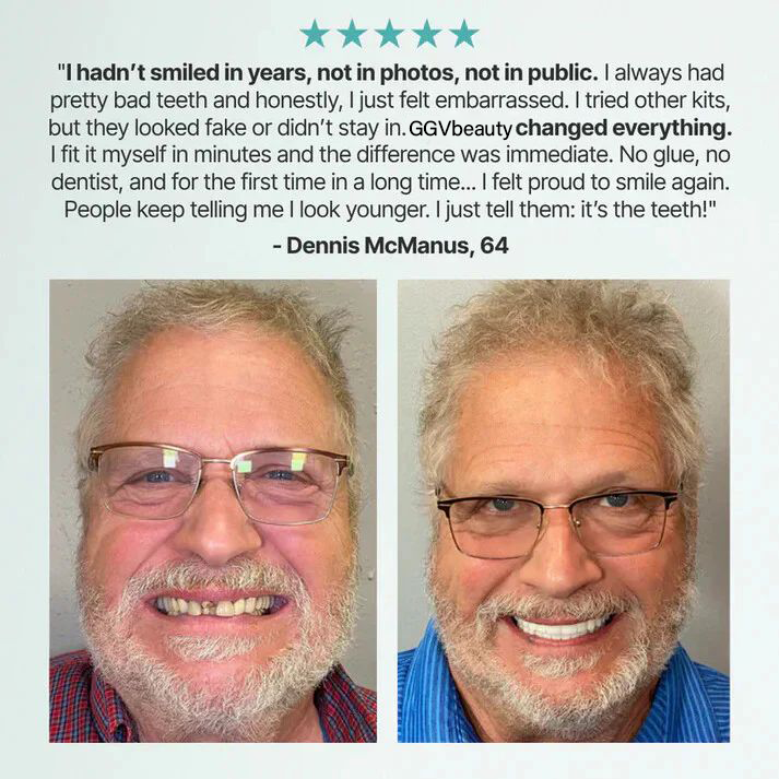 Fit Full Functional Dentures Make you more confident