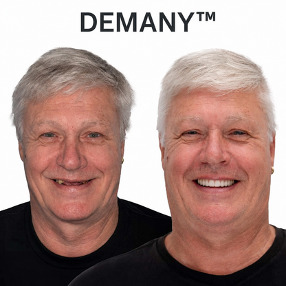 ⏰Ends Today: 70% OFF! 🌎Demany™ Medical Full Denture with Strong Suctiond🦷Obtain American Dental Association (ADA) Certification