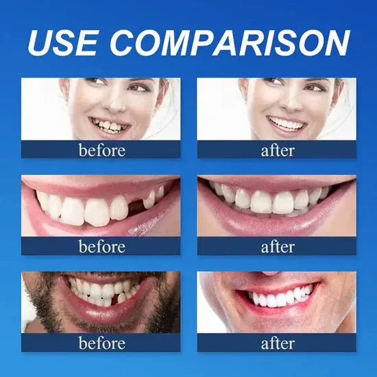 ⏰Ends Today: 70% OFF! 🌎Demany™ Medical Full Denture with Strong Suctiond🦷Obtain American Dental Association (ADA) Certification