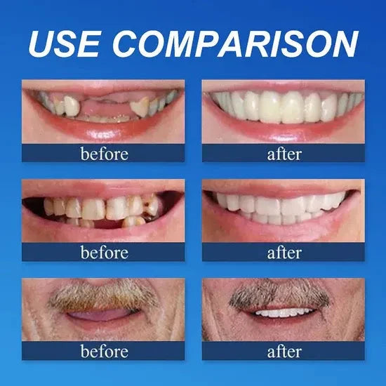 ⏰Ends Today: 70% OFF! 🌎Demany™ Medical Full Denture with Strong Suctiond🦷Obtain American Dental Association (ADA) Certification